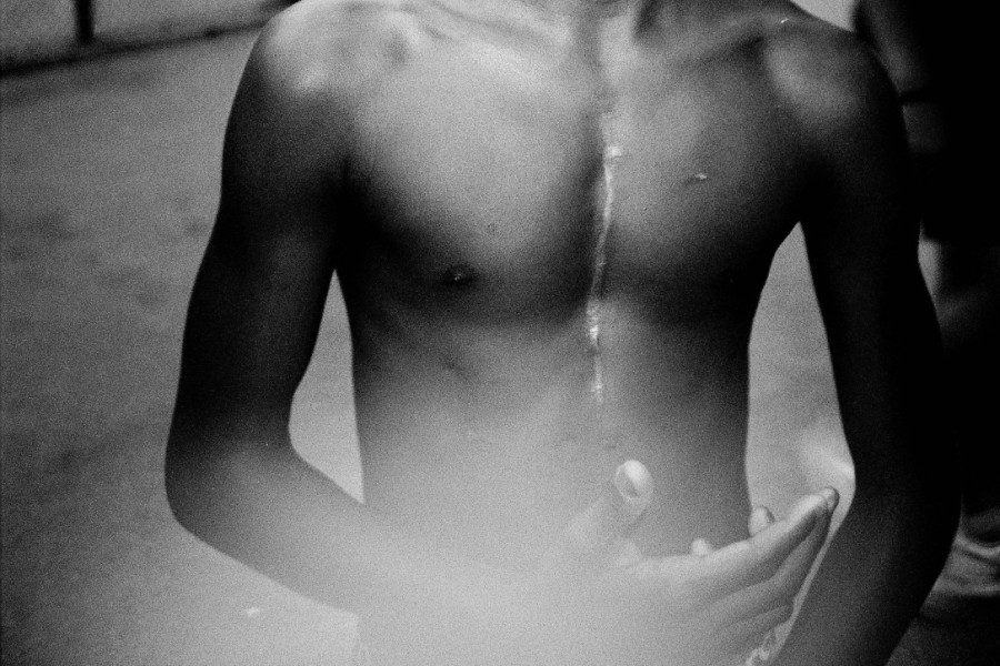 Scars of us - Mohammed Meghraoua